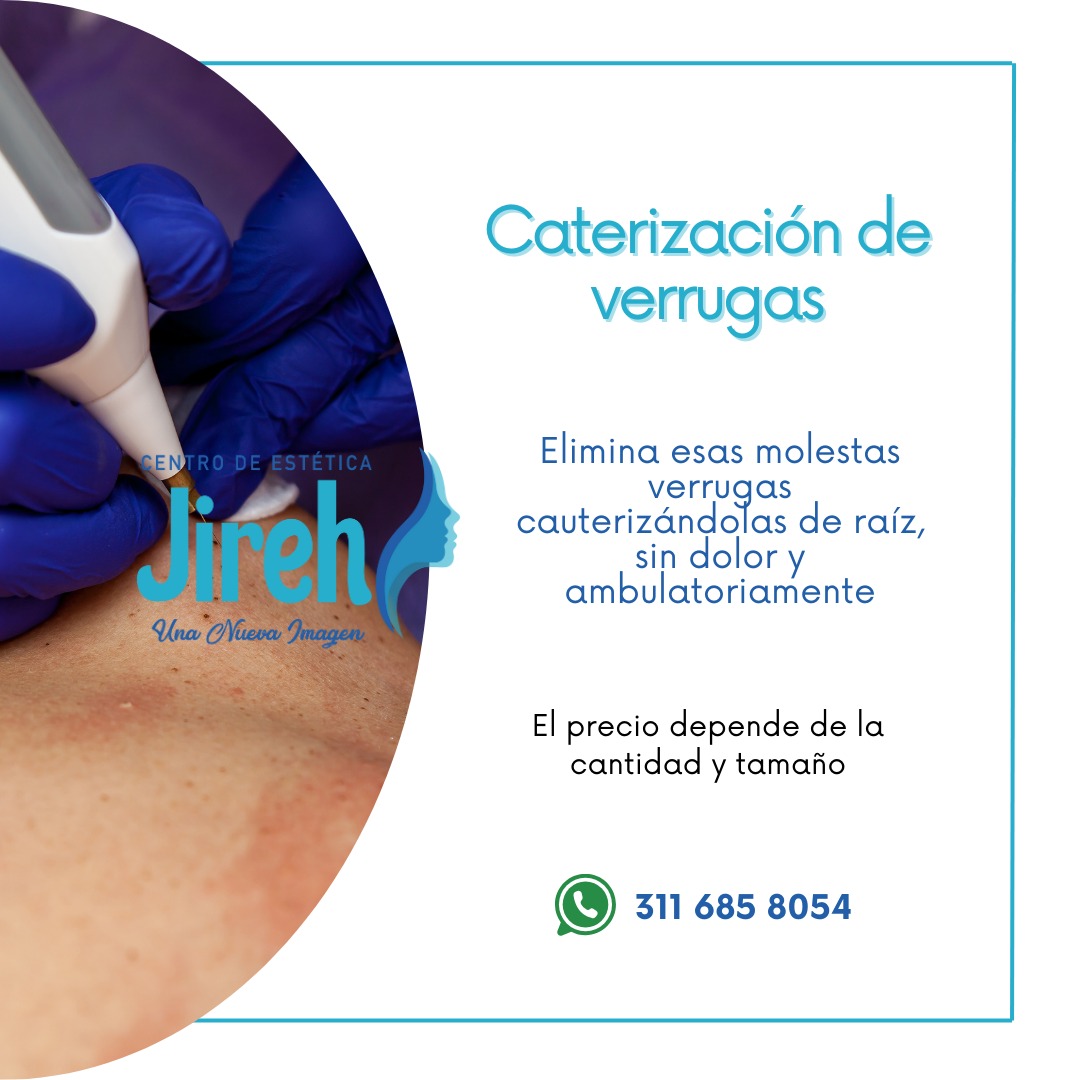 WhatsApp Image 2025-03-28 at 11.38.58 AM